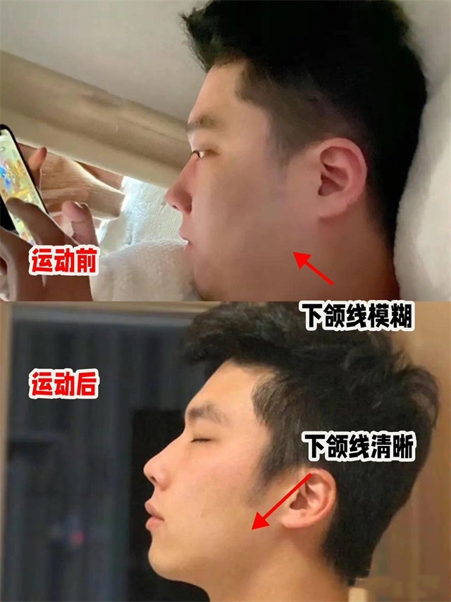 有氧运动皮肤_做有氧运动皮肤痒_有氧运动皮肤松弛怎么办